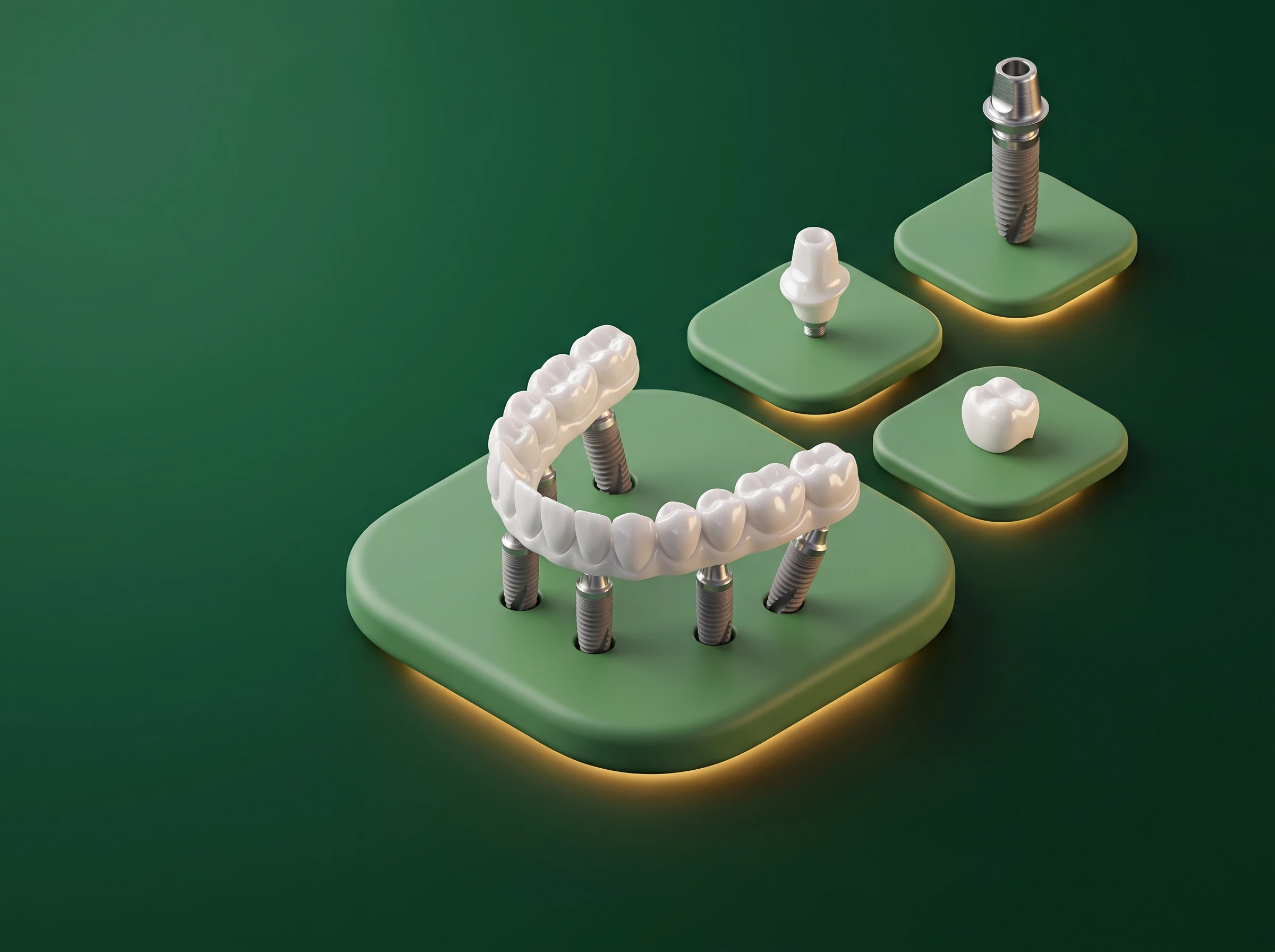 Dental services at Your Family Dentist Liverpool — implants, veneers, Invisalign and more