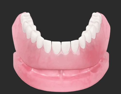 Clip-On-Dentures