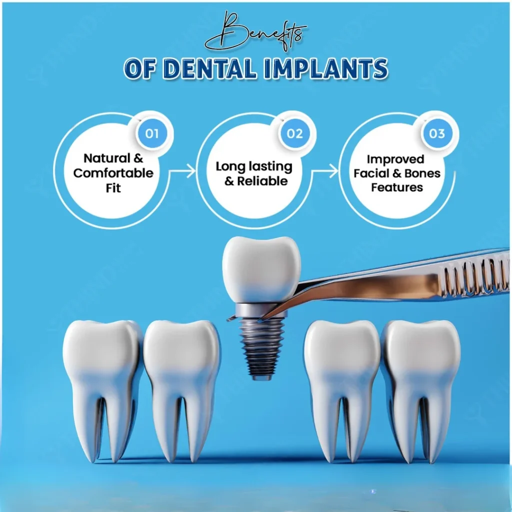 benefits of implant