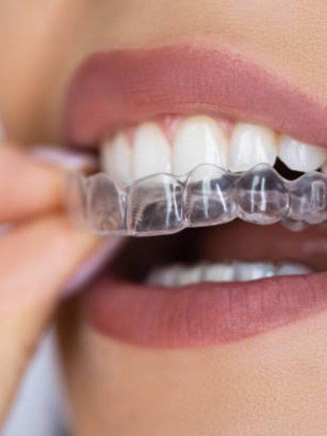 Clear Aligner Dental Night Guard For Teeth