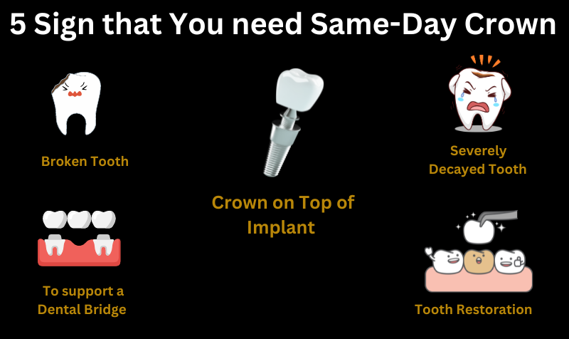 same day crown