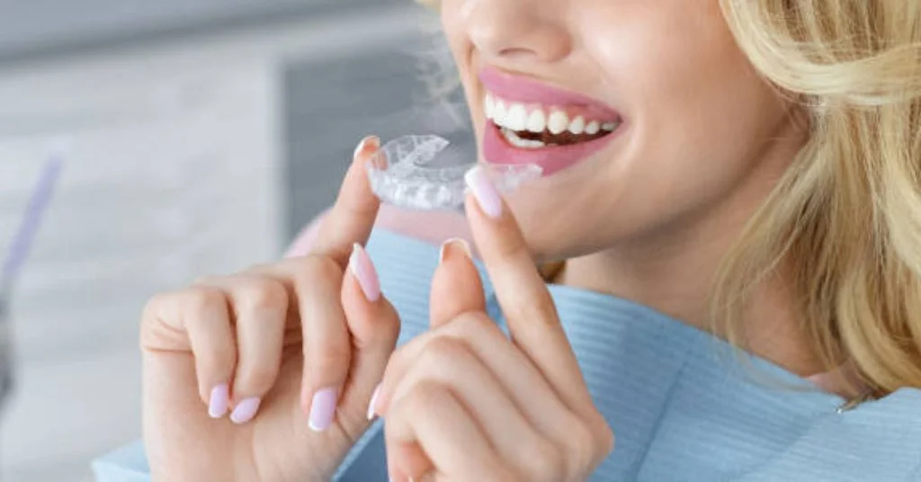 Details on teeth straightening and the cost of Invisalign in Sydne