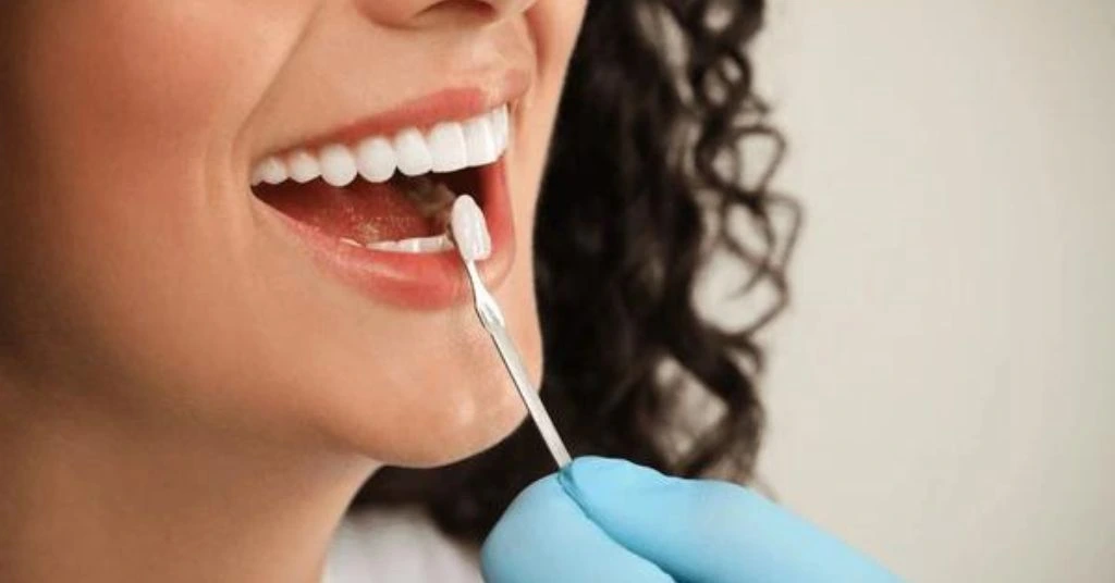 Smiling person showcasing a bright smile with dental veneers for improved appearance