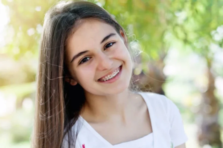 A guide on why traditional braces are best choice for kids smiles