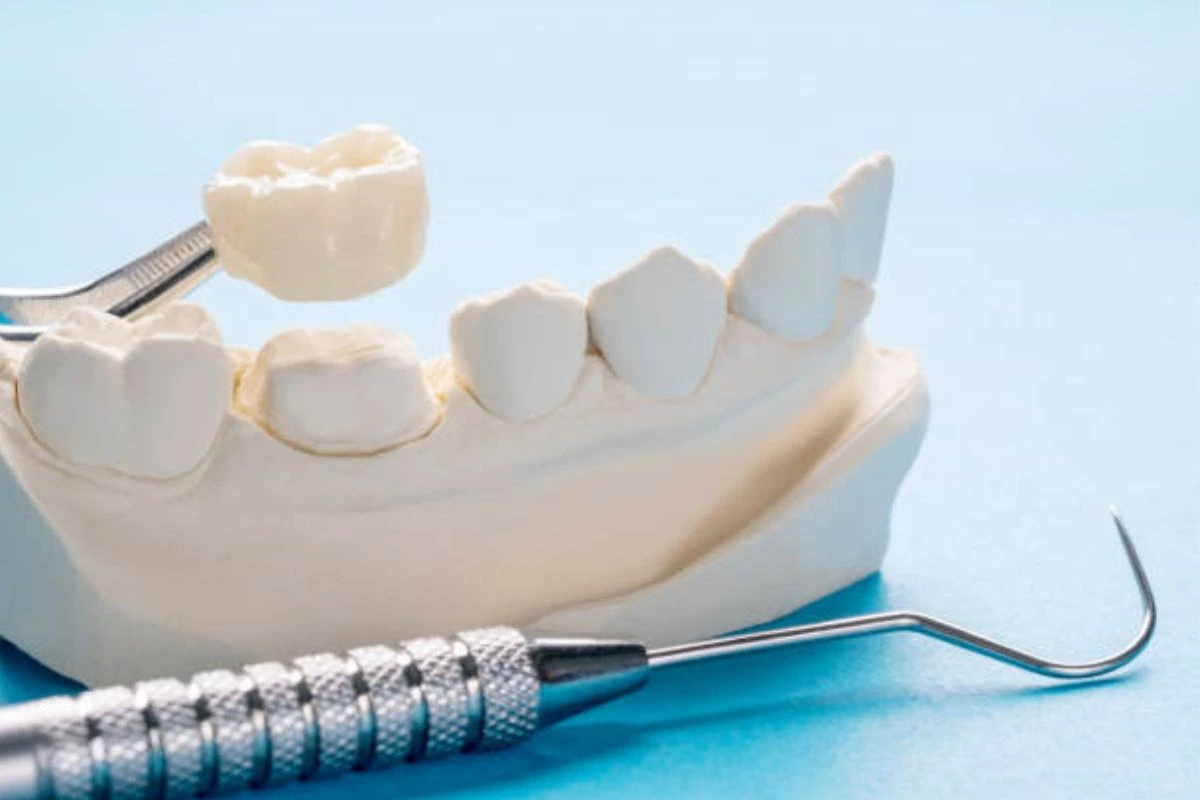 Advanced technology used for same day dental crowns in the clinic