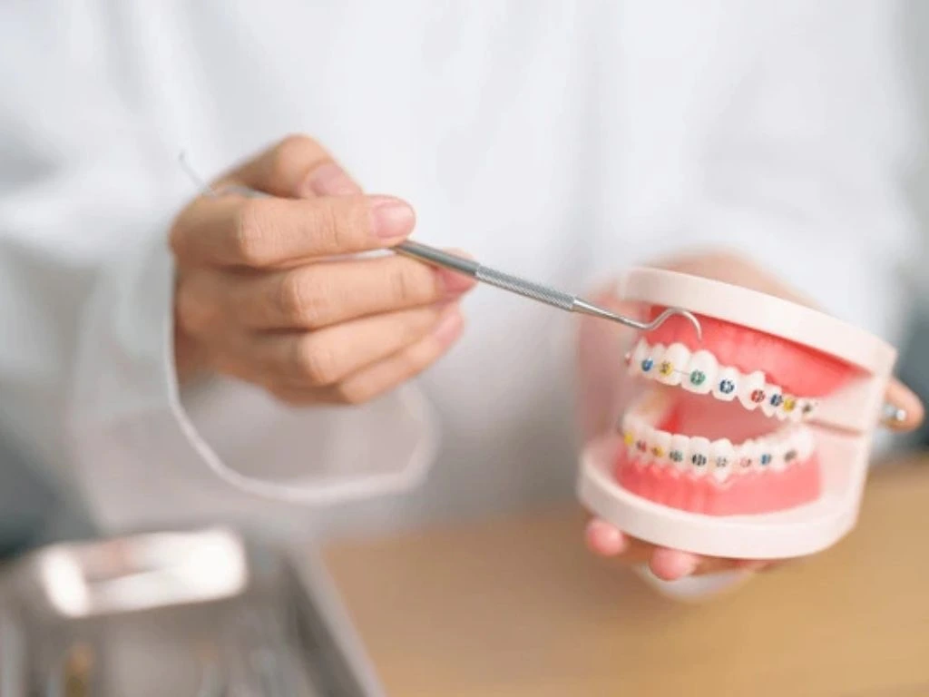 Orthodontic treatment options for braces for all ages, From teens, to adults with braces.