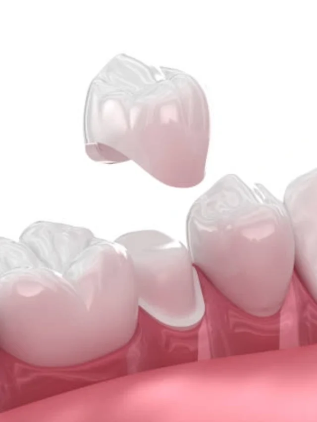 istockphoto-1479318962-612x612