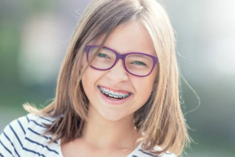 detailed guide on traditional braces for children, covering benefits, process, and care tips
