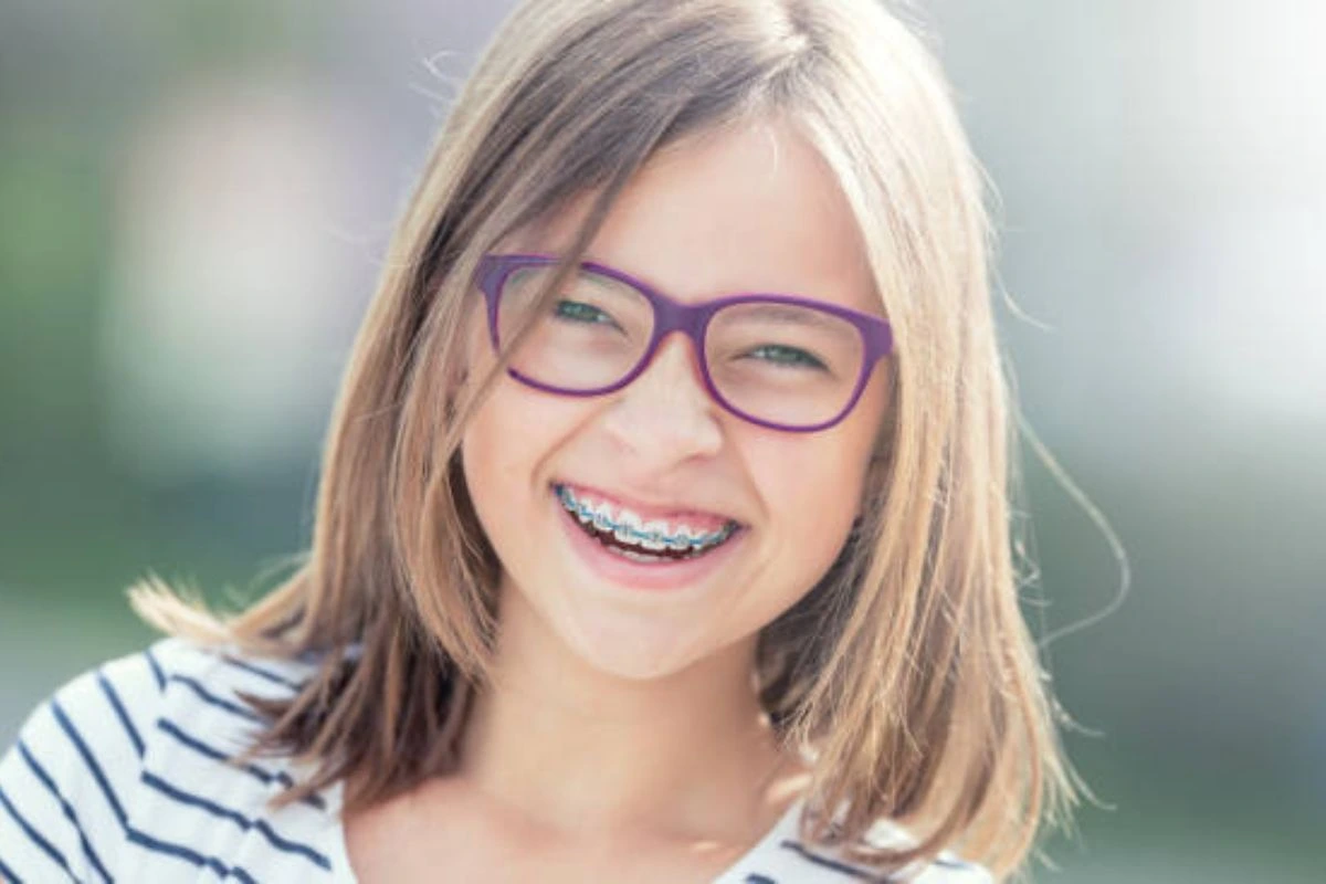 detailed guide on traditional braces for children, covering benefits, process, and care tips