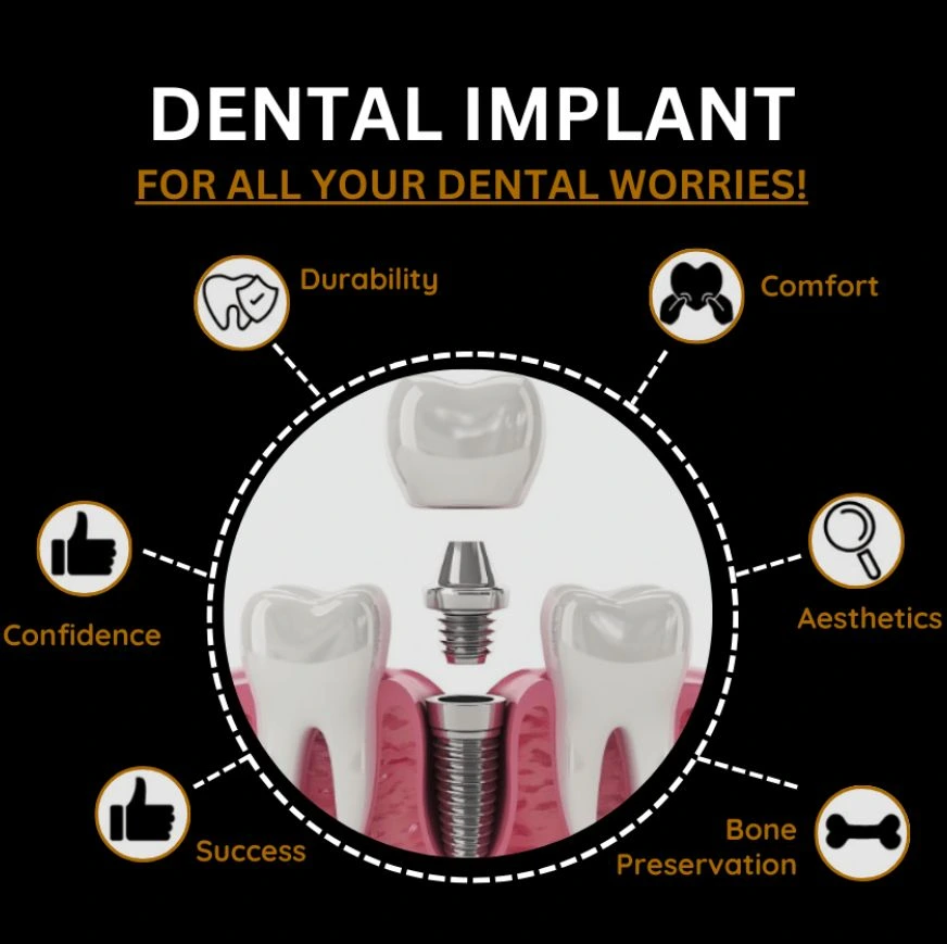 Dental implant for all your dental worries