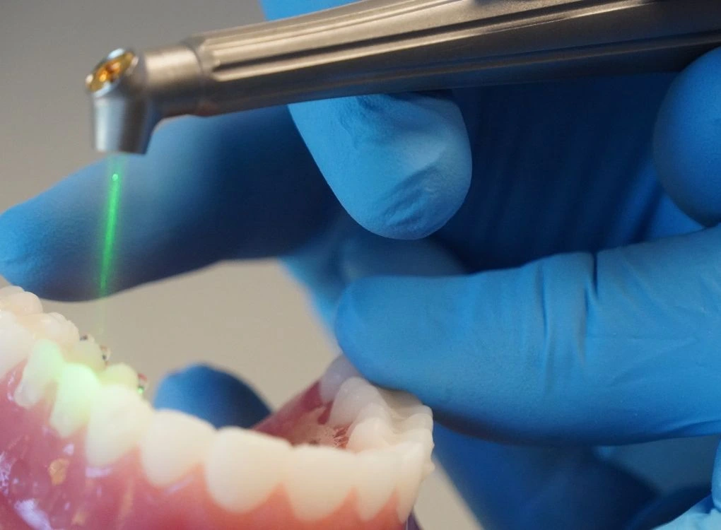 Laser dentistry