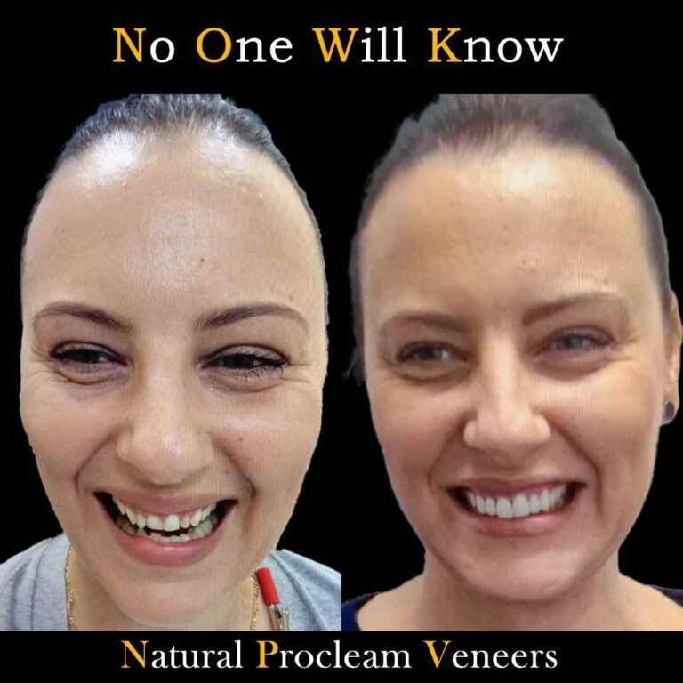 Dental implants Liverpool clinic — Dr Nick Bhayani
