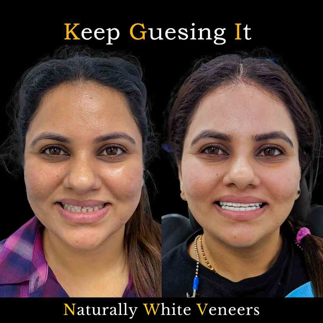 Before and after dental treatment result at Your Family Dentist
